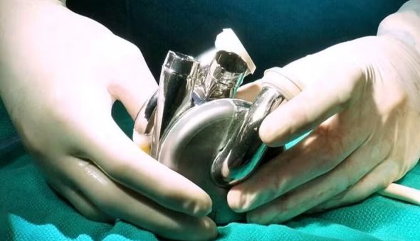 Coração artificial feito de titânio é implantado pela primeira vez em paciente humano