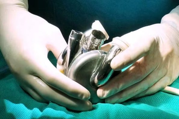 Coração artificial feito de titânio é implantado pela primeira vez em paciente humano